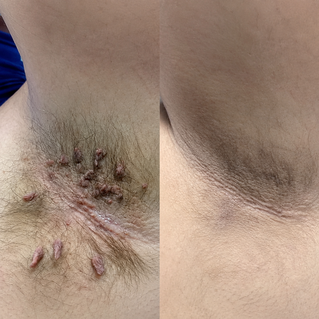 Before and after — Angela Roberts